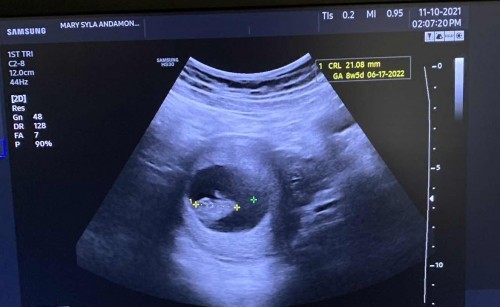 My baby @8weeks and 5 days ganyan din po ba sainyo?