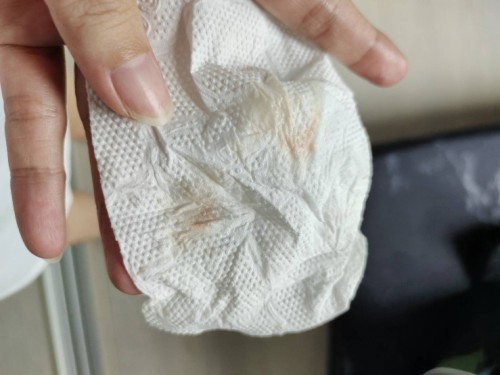 แบบนี้ใช่มูกเลือดมั้ยคะ