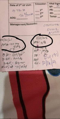 Concerns  about my prenatal  record