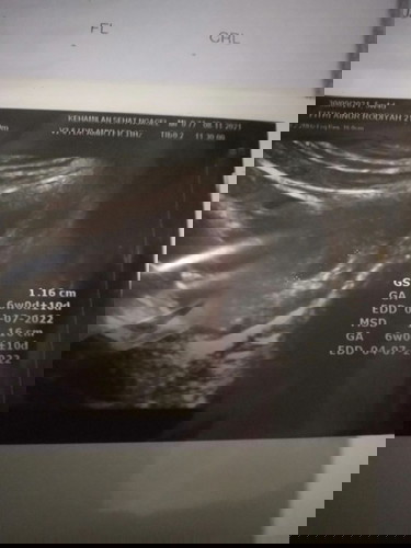 Bun mau tanyak usia kehamilan 6w mual muntah GK mau makan,Vitamin apa ya yg bisa membantu.