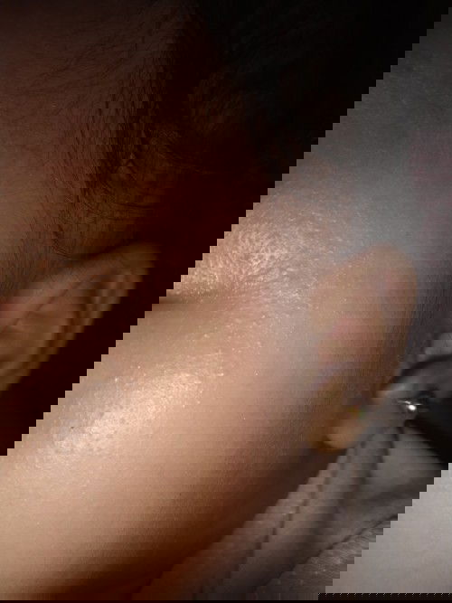 Anak bayik 8 bulan demam😥