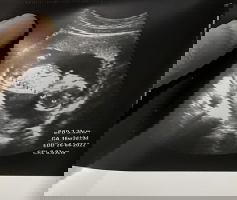 คุณหมอจะเริ่มบอกน้ำหนักทารกในครรภ์ตอนไหนหรอคะ หรือต้องถามคุณหมอตอนซาว