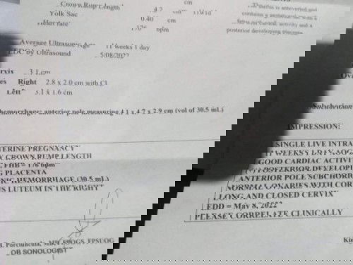 Subchorionic hemorrhage