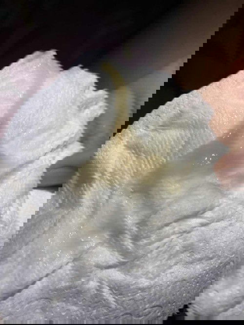 ท้องได้ 37+2วีค กำหนด 4 ธันวาคม 64