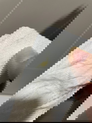 เจอตกขาวสีเหลืองๆเขียวๆ