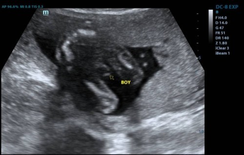 Hi. Ini confirm ke boy?