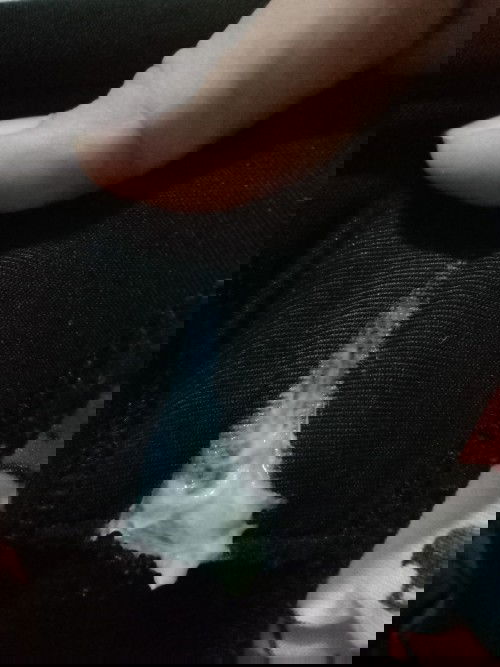 ถ้าเป็นเเบบนี้อัตรายไหมค่ะ