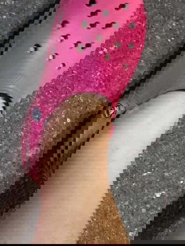 ท้อง22weekเท้าบวมกดแล้วบุ๋ม