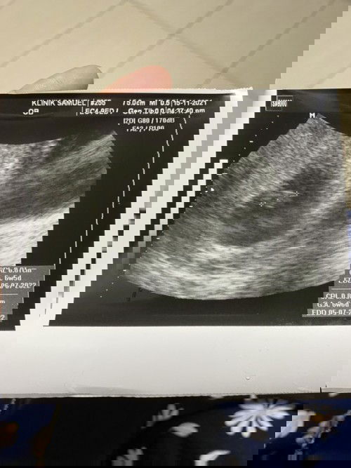 Miscarriage kali kedua. Allahuakbar 😭