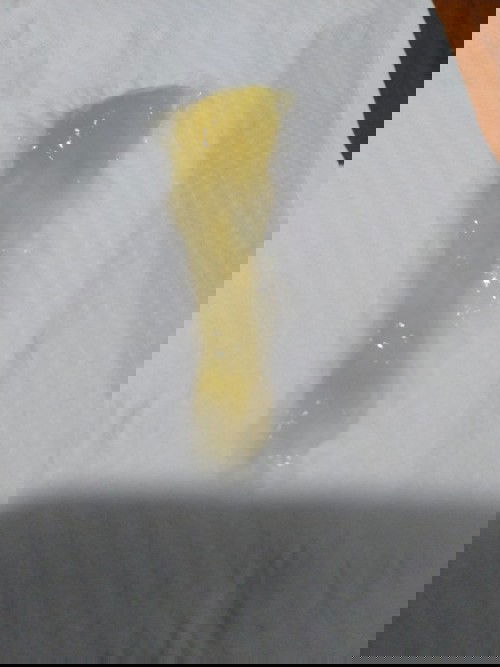 38สัปดาห์มีแบบนี้ออกมาค่ะเป็นเหนียวๆออกมาจากช่องคลอดเป็นชิ้นแบบนี้เลยค่ะอยากถามว่ามีแม่ๆคนไหนเปนบ้าง