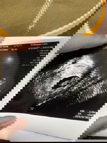 ใครมีประสบการณ์ บ้างค่ะ ท้องเเรก