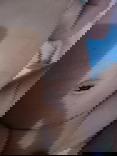 pusar basah dan berdarah