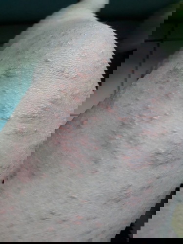 PUPPP gatelnya minta ampun