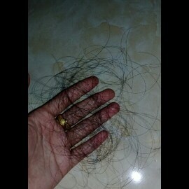 rambut rontok