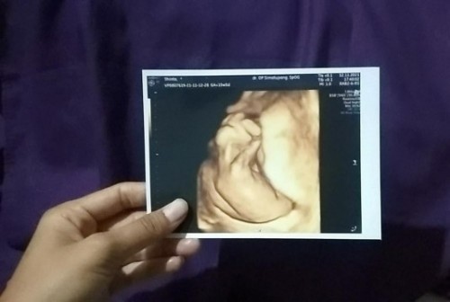 sesuai dengan perkembangannya atau tidak