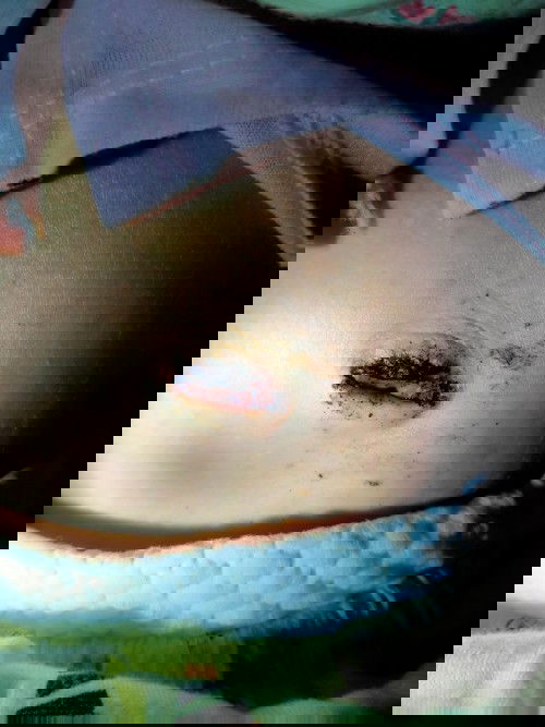 tham khảo ý kiến