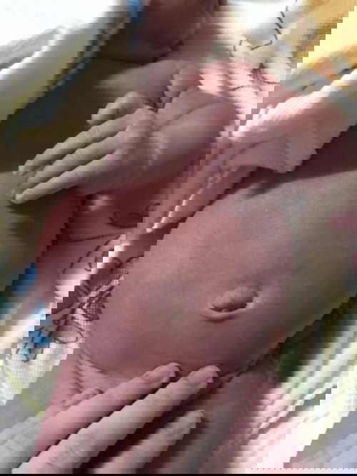 น้องได้20วัน ท้องน้องใหญ่แบบนี้ปกติมั้ยคะ