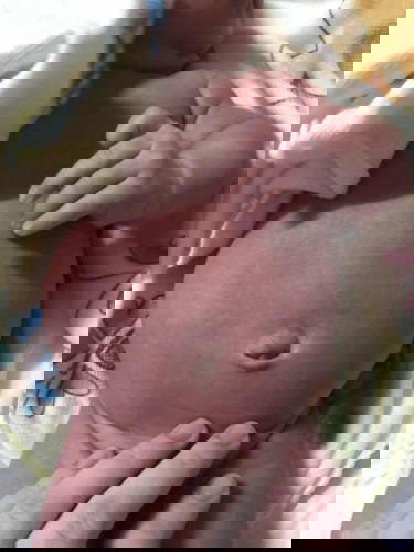 น้องได้20วัน ท้องน้องใหญ่แบบนี้ปกติมั้ยคะ