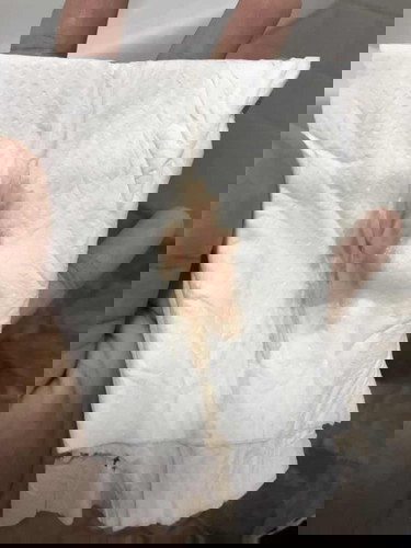 เราท้องแรกค่ะ ขอสอบถามความเห็นหรือแนะนำค่ะ