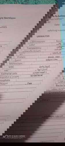 Result po ng laboratory ko may UTI poba ko ?