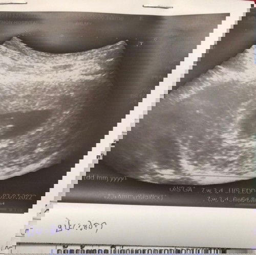 ตอนนี้หมอบอกส่าได้7 สัปดาห์อยากทราบว่าตอนนี้ลูกพัฒนาการอย่างไรแต่คุณแม่แพ้ท้องหนักมากกินไรก็ไม่ค่อยได้เลยค่ะ