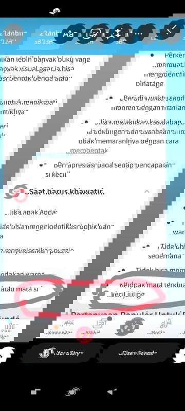 Apakah diumur 2th3 bulan mata si kecil bisa berubah juling dari sebelumnya normal?
