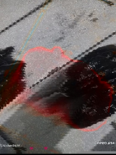 5weeks 6days pregnant