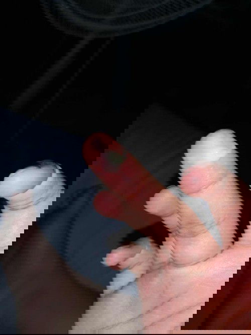 ถามแม่ๆหน่อยค่ะ แบบนี้เรียกมูกหรือตกขาวอะคะ 🙏🏻