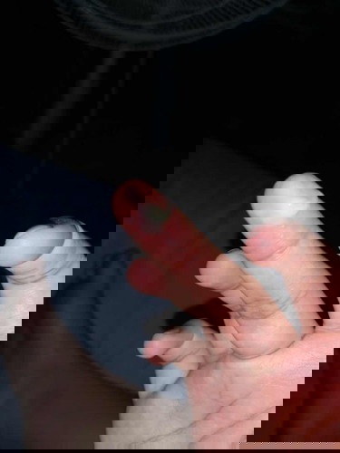 ถามแม่ๆหน่อยค่ะ แบบนี้เรียกมูกหรือตกขาวอะคะ 🙏🏻