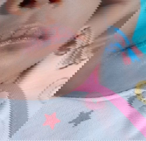 Bibir kering bayi 2 bulan