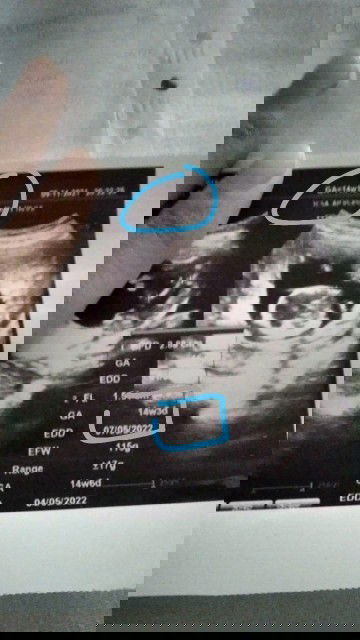 Menghitung usia usg gmna?