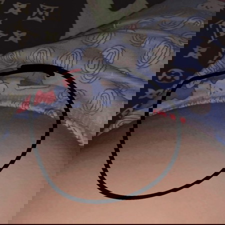 เราเจ็บตรงนี้มากเลยค่ะ