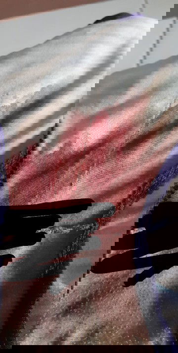 Perdarahan setelah nifas