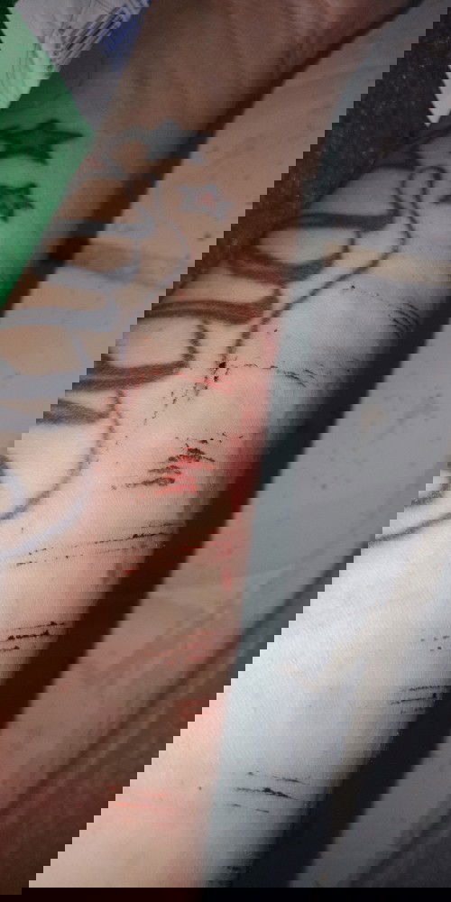 Perjuanganku mempertahankan anakku PART 2