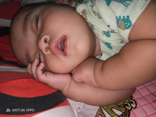 Diare bayi