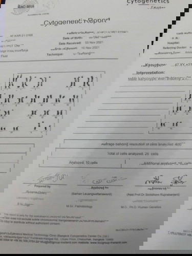 น้องเป็นดาวน์