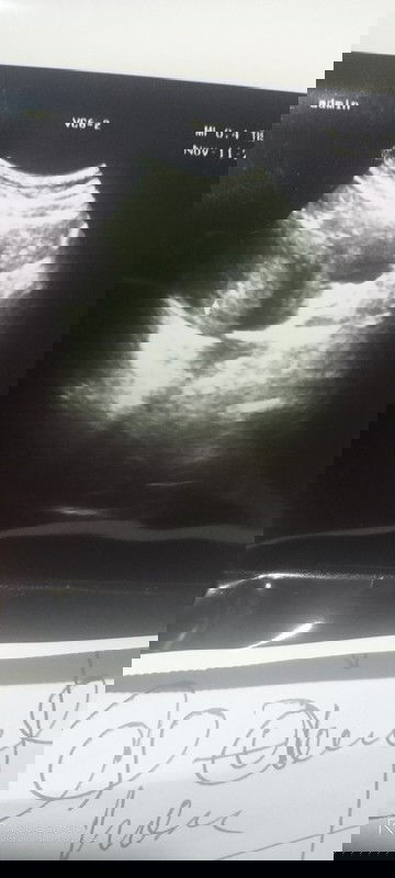 Hasil usg 11 November 2021