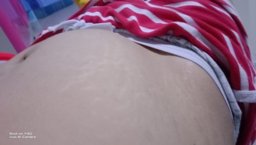 Bkt po .. madalas manigas sa puson 3 months pregnant napo.ako.at madalas bumukol