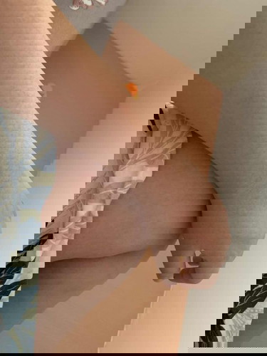 Gatal”di kaki tangan,perut.itu penyebab nya gara”apa ya??bahaya ga?harus pakai obat ap? aku dah di trisemester 3 🙏🏻