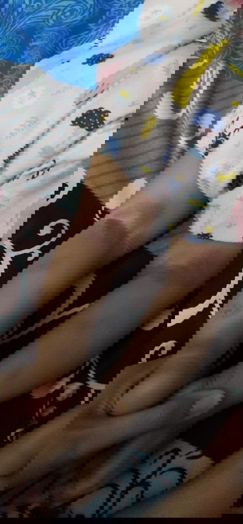 Kl kaki merah merah dan berair obatnya apa bun kasihan gak sembuh sembuh#seriusnanya #bantusharing #