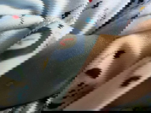 Tangan merah merah berair