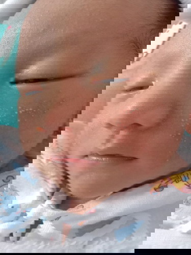 ผื่นขึ้นหน้าเกิดจากสาเหตุอะไรคะ เเละรักษายังไง น้องพึ่งได้8วันค่ะ