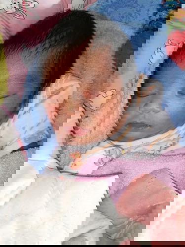 ลูกชายอายุ7วันหน้ามีผดผื่นขึ้นที่หน้าใช้อะไรให้ลูกกลับมาหน้าใสปกติได้ค่ะแม่ๆคนไหนมีวิธีแนะนำหน่อยค่ะ