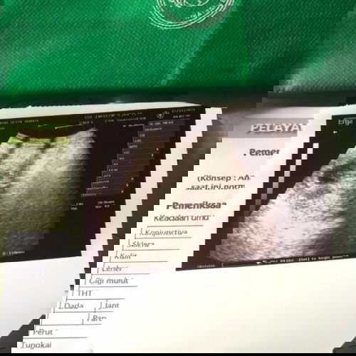 My Little Baby ❤️