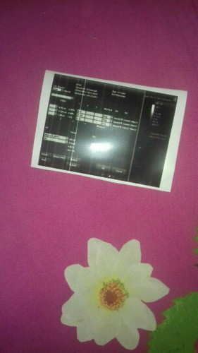 Beda hasil foto usg nya