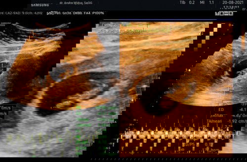 Sekedar sharing ya bunda2 cantik 🥰