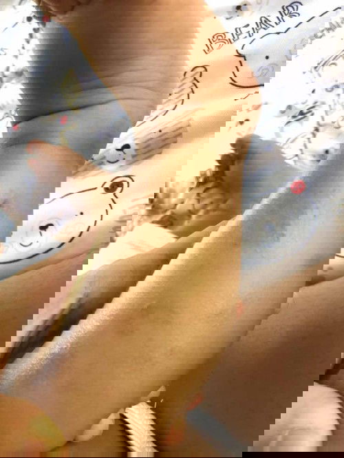 อยากทราบว่าลูกคุณแม่มีเป็นแบบนี่กันมั้ยคะ?