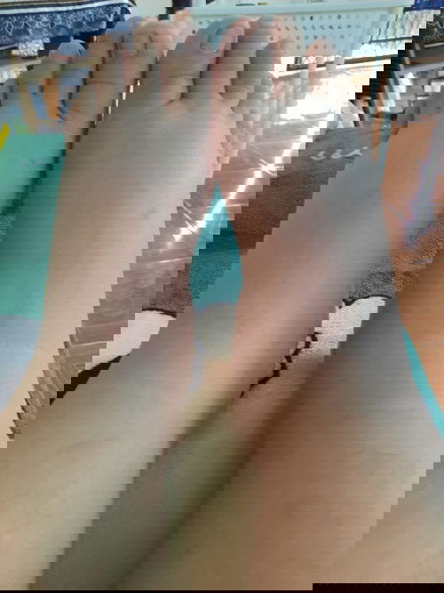 เท้าบวมหลังคลอด