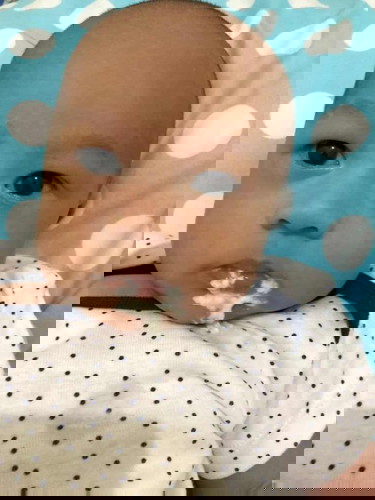 gumoh keluar endapan susu