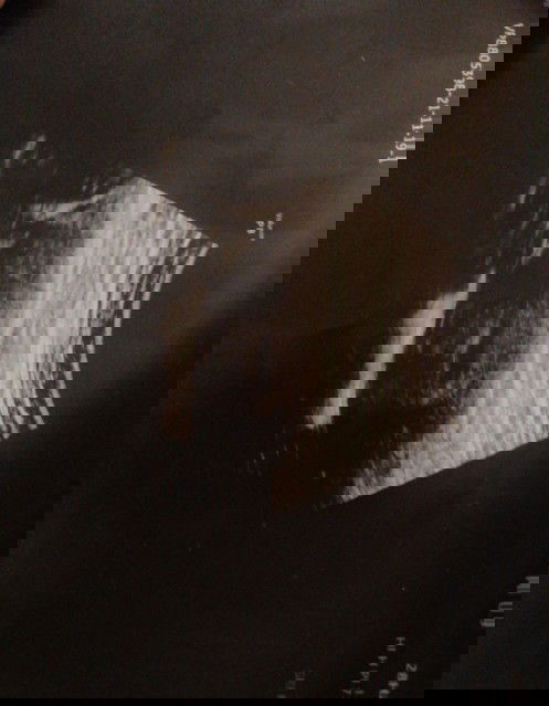 Scanning awal kehamilan